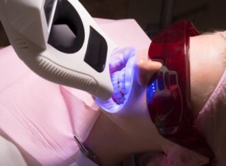 Jak skutecznie rozjaśnić uśmiech Proces wybielania zębów w pigułce