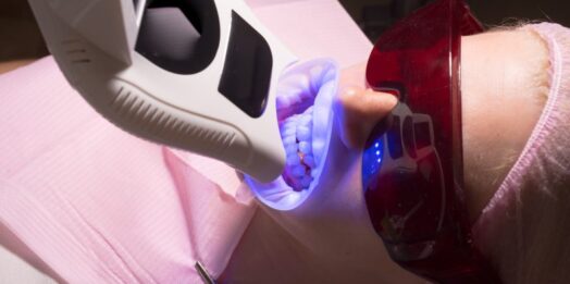 Jak skutecznie rozjaśnić uśmiech Proces wybielania zębów w pigułce